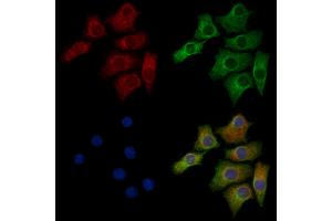 ABIN6263875 and ABIN6272705 staining HepG2 cells by IF/ICC.