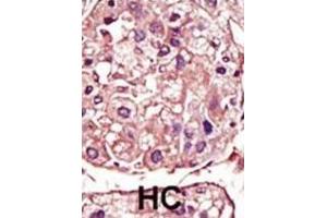 Immunohistochemistry (IHC) image for anti-Transforming Growth Factor, beta Receptor 1 (TGFBR1) antibody (ABIN3003515) (TGFBR1 antibody)