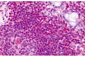Human Lymphocytes: Formalin-Fixed, Paraffin-Embedded (FFPE) (CCDC50 antibody  (AA 468-481))
