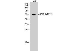 Western Blotting (WB) image for anti-Myelin Expression Factor 2 (MYEF2) (pThr319) antibody (ABIN3182063) (MYEF2 antibody  (pThr319))