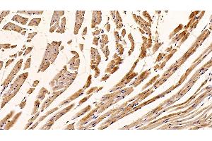 Detection of C1QBP in Mouse Cardiac Muscle Tissue using Polyclonal Antibody to Complement component 1 Q subcomponent-binding protein, mitochondrial (C1QBP) (C1QBP antibody  (AA 71-278))