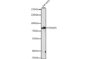 Western blot analysis of extracts of rat testis, using DN antibody (ABIN7268219) at 1:1000 dilution. (LRRC50 antibody  (AA 516-725))