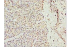 Immunohistochemistry of paraffin-embedded human pancreatic tissue using ABIN7167363 at dilution of 1:100 (Rab5c antibody  (AA 1-216))