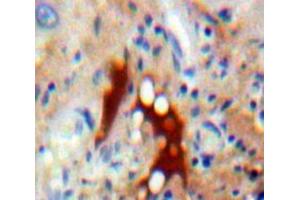 IHC-P analysis of Liver tissue, with DAB staining. (ASK1 antibody  (AA 693-933))