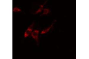 ABIN6274861 staining Hela cells by IF/ICC. (ARFIP1 antibody  (Internal Region))