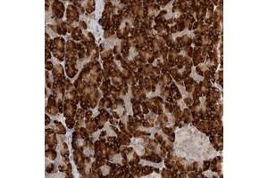Immunohistochemical staining of human pancreas with NXT2 polyclonal antibody  shows strong cytoplasmic positivity in exocrine cells.
