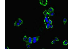Immunofluorescent analysis of PC-3 cells using ABIN7155221 at dilution of 1:100 and Alexa Fluor 488-congugated AffiniPure Goat Anti-Rabbit IgG(H+L) (HPCAL1 antibody  (AA 2-193))
