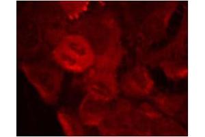 Image no. 1 for anti-Mitogen-Activated Protein Kinase Kinase 2 (MAP2K2) (pThr394) antibody (ABIN196623) (MEK2 antibody  (pThr394))