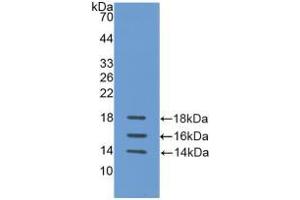 Western blot analysis of recombinant Human IL15.