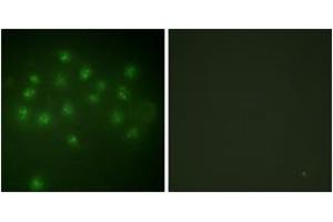Immunofluorescence analysis of A549 cells, using Vitamin D Receptor (Phospho-Ser208) Antibody. (Vitamin D Receptor antibody  (pSer208))