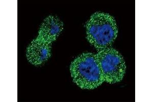 Confocal immunofluorescent analysis of anti-AKT antibody with MDA-MB435 cells followed by Alexa Fluor 488-conjugated goat anti-rabbit lgG (green). (AKT1 antibody  (AA 49-76))