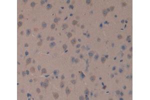Used in DAB staining on fromalin fixed paraffin- embedded brain tissue (TOP1MT antibody  (AA 11-238))