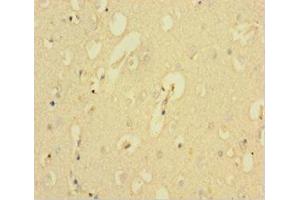 Immunohistochemistry of paraffin-embedded human brain tissue using ABIN7146334 at dilution of 1:100 (KCNMA1 antibody  (AA 1-86))