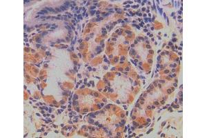Used in DAB staining on fromalin fixed paraffin- embedded stomach tissue (QARS antibody  (AA 514-775))