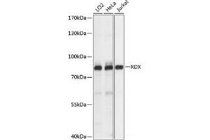 Western blot analysis of extracts of various cell lines using RDX Polyclonal Antibody at dilution of 1:1000. (Radixin antibody)
