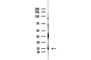 anti-ATP Synthase, H+ Transporting, Mitochondrial Fo Complex, Subunit D (ATP5H) (C-Term) antibody