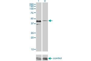 Western blot analysis of CSNK1G1 over-expressed 293 cell line, cotransfected with CSNK1G1 Validated Chimera RNAi (Lane 2) or non-transfected control (Lane 1). (CSNK1G1 antibody  (AA 293-393))