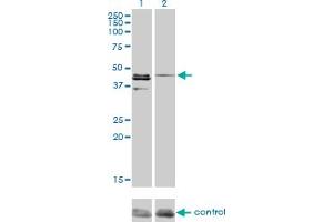 Western blot analysis of CSNK1G1 over-expressed 293 cell line, cotransfected with CSNK1G1 Validated Chimera RNAi (Lane 2) or non-transfected control (Lane 1). (CSNK1G1 antibody  (AA 293-393))