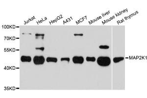 Western blot analysis of extracts of various cell lines, using MAP2K1 antibody. (MEK1 antibody  (AA 1-100))
