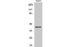 Western Blotting (WB) image for anti-Actin, beta-Like 2 (ACTBL2) (Internal Region) antibody (ABIN3173670) (ACTBL2 antibody  (Internal Region))