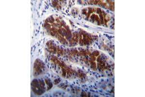 Immunohistochemistry (IHC) image for anti-Fyn-Related Kinase (FRK) antibody (ABIN3003444) (FRK antibody)