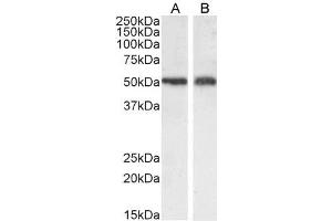 SLC7A11 anticorps  (Internal Region)
