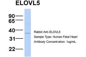 Host:  Rabbit  Target Name:  ELOVL5  Sample Type:  Human Fetal Heart  Antibody Dilution:  1. (ELOVL5 antibody  (N-Term))