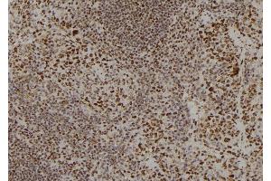 ABIN6278790 at 1/100 staining Mouse spleen tissue by IHC-P. (APOBEC3C antibody)
