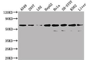 Western Blot Positive WB detected in: A549 whole cell lysate, 293T whole cell lysate, L02 whole cell lysate, HepG2 whole cell lysate, Hela whole cell lysate, SH-SY5Y whole cell lysate, K562 whole cell lysate, Mouse liver tissue All lanes: SLC23A1 antibody at 1:2000 Secondary Goat polyclonal to rabbit IgG at 1/50000 dilution Predicted band size: 65, 66, 29 kDa Observed band size: 80 kDa (SLC23A1 antibody  (AA 173-259))