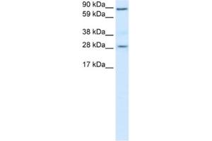 Western Blotting (WB) image for anti-B-Cell CLL/lymphoma 2 (BCL2) antibody (ABIN2463648) (Bcl-2 antibody)