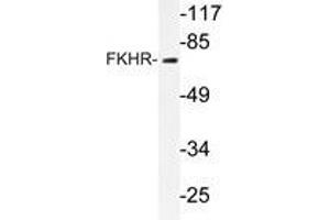 Western blot analysis of FKHR antibody in extracts from HeLa cells. (FOXO1 antibody)