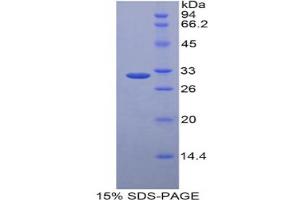 SDS-PAGE analysis of Human LRP5L Protein. (LRP5L Protein)