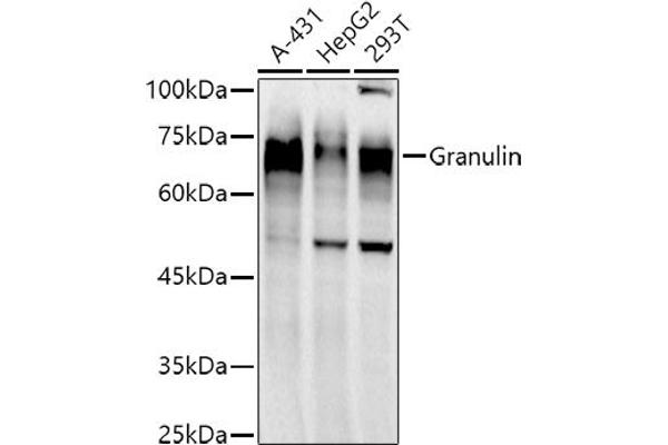 Granulin 抗体