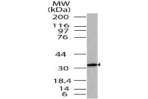 Image no. 1 for anti-ST2V Or ST2 (AA 150-300) antibody (ABIN5027547) (ST2V Or ST2 (AA 150-300) antibody)