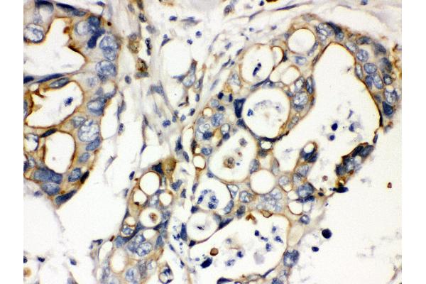 PLEC antibody  (Middle Region)