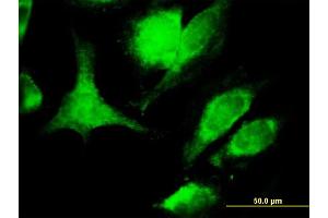Immunofluorescence of monoclonal antibody to TNFSF6 on HeLa cell. (FASL antibody  (AA 1-281))