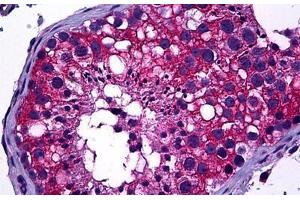 Human Testis: Formalin-Fixed, Paraffin-Embedded (FFPE) (DIAPH2 antibody  (AA 56-114))