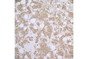 Immunohistochemistry (IHC) image for anti-Heat Shock 27kDa Protein 1 (HSPB1) (AA 150-200) antibody (ABIN7453910)