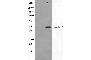 Western blot analysis on HuvEc cell lysate using Keratin 17 Antibody. (KRT17 antibody  (C-Term))