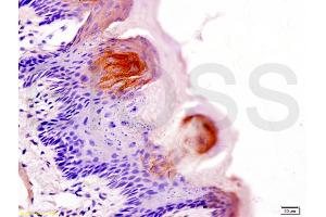 Formalin-fixed and paraffin embedded rat tongue labeled with Anti-AQP-3 Polyclonal Antibody, Unconjugated (ABIN673974) at 1:200 followed by conjugation to the secondary antibody and DAB staining (AQP3 antibody  (AA 201-292))