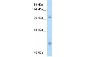 WB Suggested Anti-NFKB1 Antibody Titration:  0.