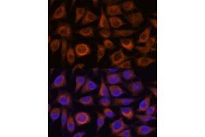 Immunofluorescence analysis of L929 cells using TRIM16 antibody (ABIN7270978) at dilution of 1:100.