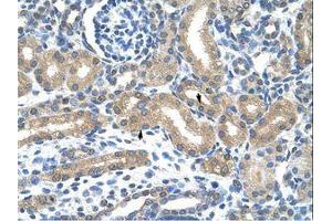 Image no. 1 for anti-Hypoxia Inducible Factor 3, alpha Subunit (HIF3A) (C-Term) antibody (ABIN203237) (HIF3A antibody  (C-Term))