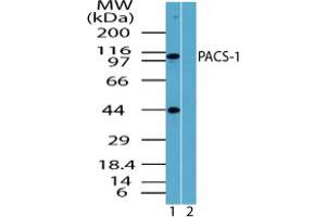Image no. 1 for anti-phosphofurin Acidic Cluster Sorting Protein 1 (PACS1) (AA 300-350) antibody (ABIN960302)