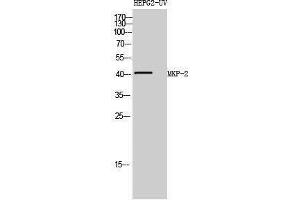 Western Blotting (WB) image for anti-Dual Specificity Phosphatase 4 (DUSP4) (Internal Region) antibody (ABIN3185575) (DUSP4 antibody  (Internal Region))