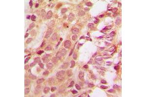 Immunohistochemical analysis of MCL1 staining in human tonsil formalin fixed paraffin embedded tissue section.