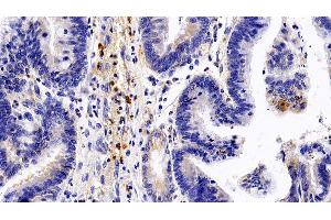 Immunohistochemistry (IHC) image for anti-Colony Stimulating Factor 3 Receptor (Granulocyte) (CSF3R) (AA 26-138) antibody (ABIN7437143)