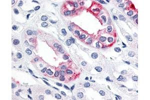 Anti-ESRRG / ERR Gamma antibody IHC of human kidney. (ESRRG antibody  (C-Term))