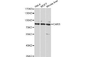Western blot analysis of extracts of various cell lines, using CARS antibody (ABIN2561571) at 1:1000 dilution. (CARS antibody)