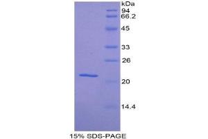 SDS-PAGE (SDS) image for Haptoglobin (HP) (AA 71-248) protein (His tag) (ABIN2121189) (Haptoglobin Protein (HP) (AA 71-248) (His tag))